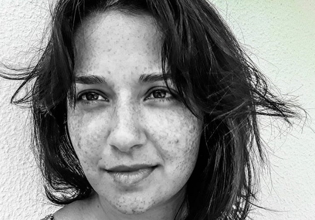 Belleza natural!. La actriz venezolana Daniela Alvarado mostró la realidad de su rostro. Dice “PECAS… Si, tengo millones de ellas.