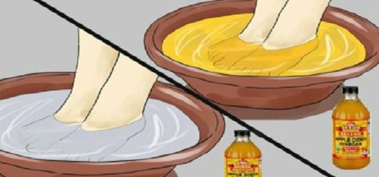 Cómo Desintoxicarte A Través De Tus Pies