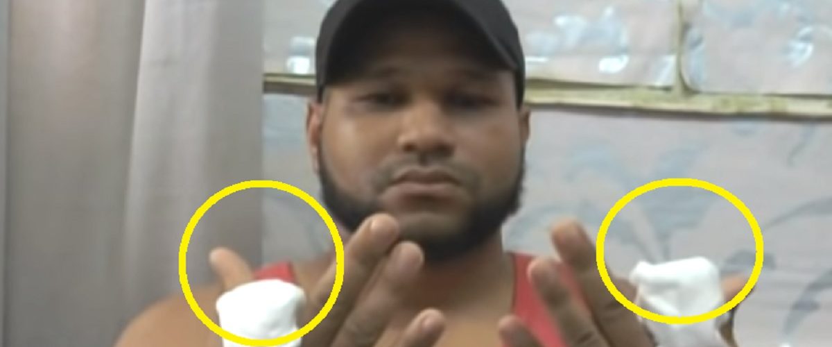 Cortan dos dedos de las manos a joven que fue secuestrado en Hato Mayor