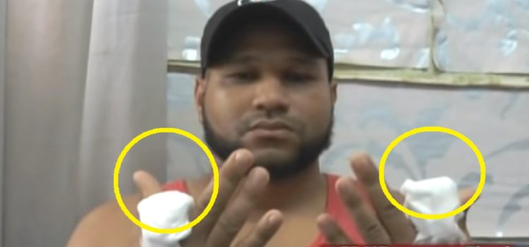 Cortan dos dedos de las manos a joven que fue secuestrado en Hato Mayor
