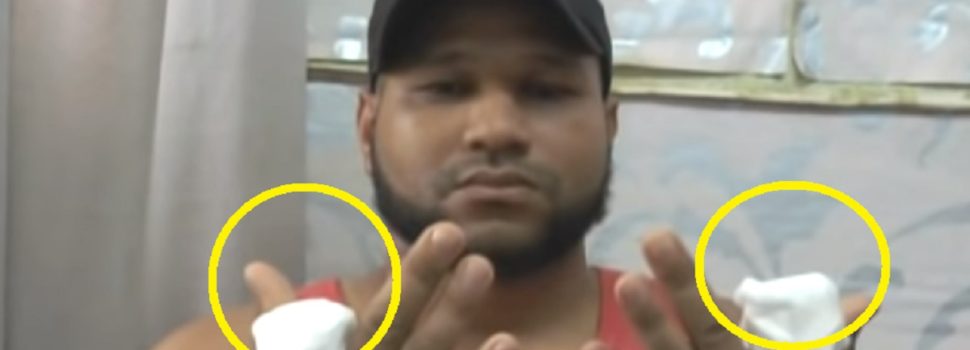 Cortan dos dedos de las manos a joven que fue secuestrado en Hato Mayor