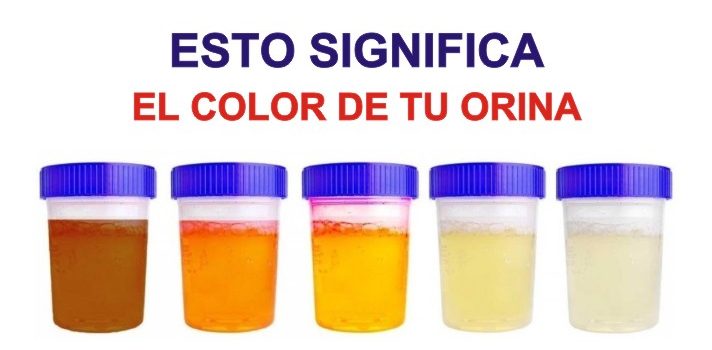 7 Cosas que tu orina está tratando de decirte sobre tu salud