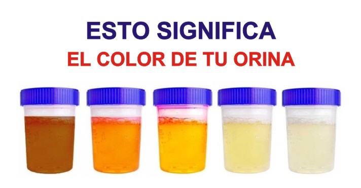 7 Cosas que tu orina está tratando de decirte sobre tu salud