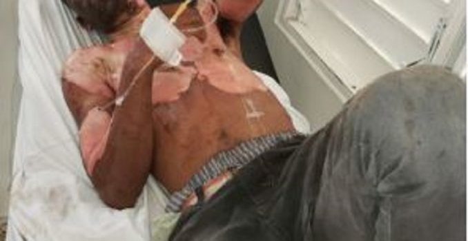 Hombre se prende fuego por problemas con su expareja