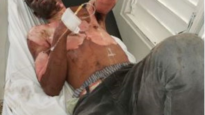 Hombre se prende fuego por problemas con su expareja